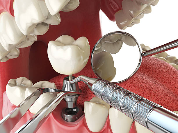 Best Emergency Care for Gum Disease in Labasas, CA
